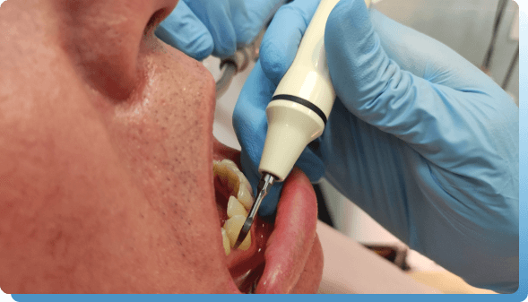 dentina parodontologija slika 4