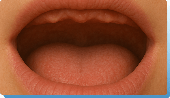 Nivelacija alveolarnog grebena Dentina Novi Sad