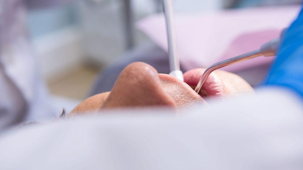 Rezanj operacija Dental centar Djuric