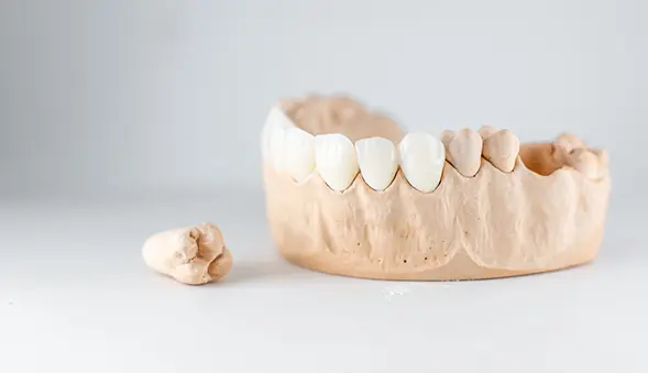 Vadjenje zuba Stomatoloska ordinacija Dentina Novi Sad