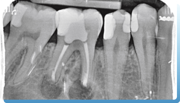 dentina oralna hirurgija slika 1