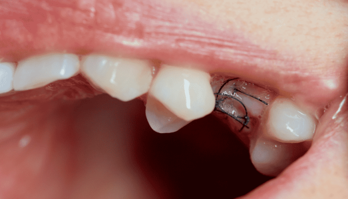 DENTINA IMPLANTI min (1)